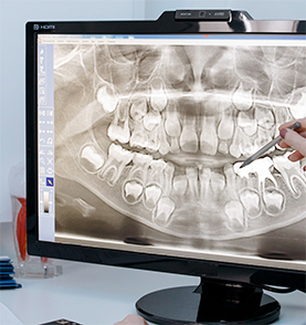 taking dental xrays